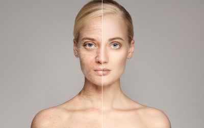 „Omega-3: Bremse für biologisches Altern?“