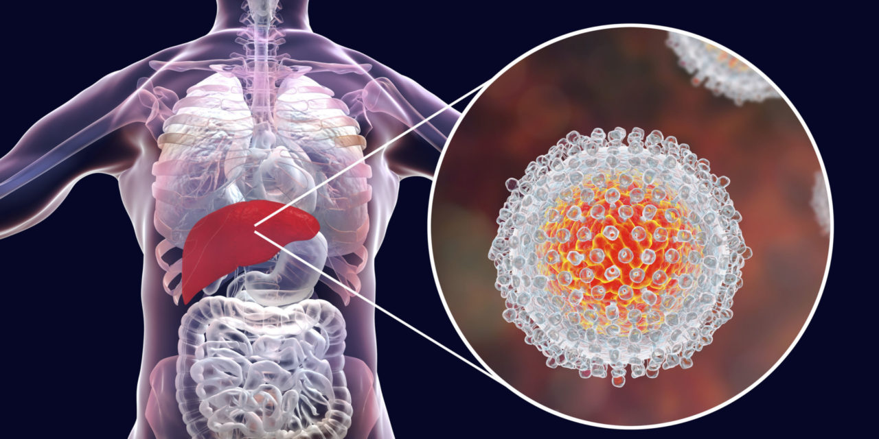 Hepatitis C – was kann die Naturheilkunde?