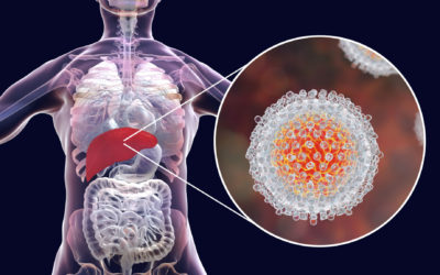 Hepatitis C – was kann die Naturheilkunde?