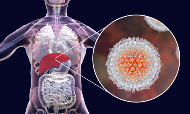 Hepatitis C – was kann die Naturheilkunde?